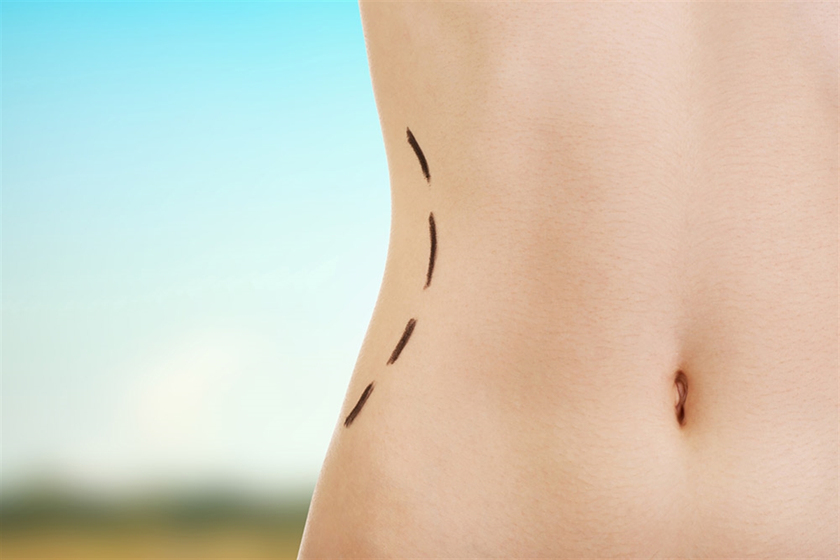 Body Shaping Surgery Procedures